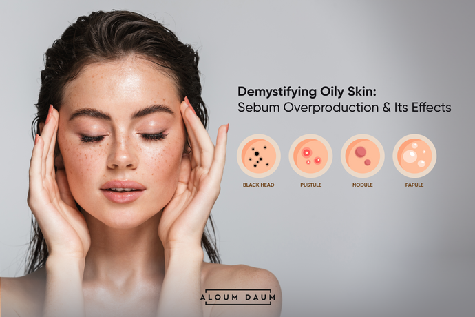 Demystifying Oily Skin: Overproduction of Sebum and its Impact on the Skin